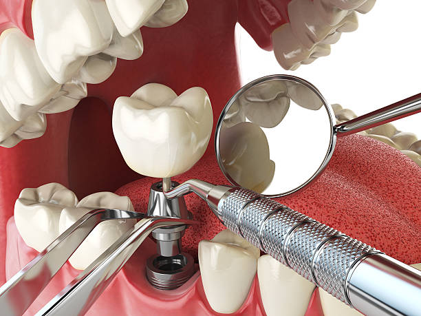 Best 24-Hour Emergency Dental Care in Rden City, GA